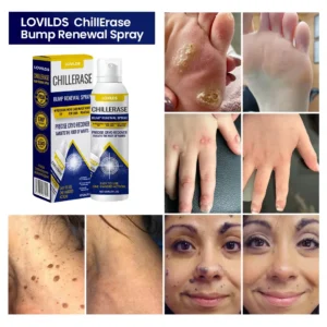 🔥𝙁𝙞𝙣𝙖𝙡 3 𝙃𝙤𝙪𝙧𝙨: 60% 𝙊𝙁𝙁: LOVILDS™ ChillErase Bump Renewal Spray🔥