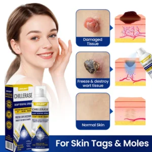 Alternative view of LBMLBM™ ChillErase Bump Renewal Spray