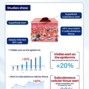 NESLEMY® ChillErase Bump Renewal Spray