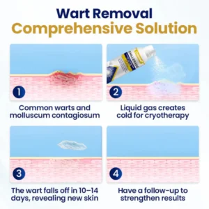 Alternative view of Celsiora® ChillErase Cooling Spray for Skin Tags