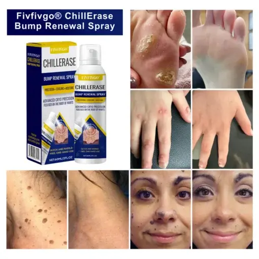 Fivfivgo® ChillErase Bump Renewal Spray