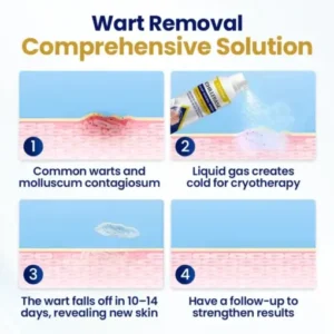 Fivfivgo® ChillErase Bump Renewal Spray