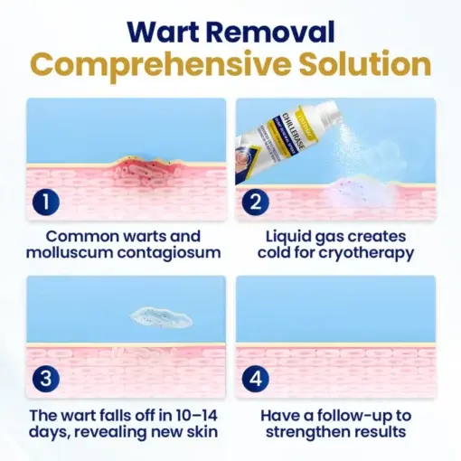 Fivfivgo® ChillErase Bump Renewal Spray