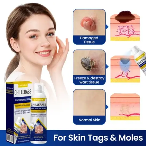 Fivfivgo® ChillErase Bump Renewal Spray