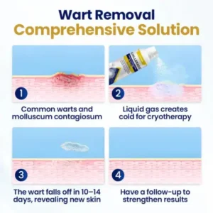 KUBOZN® ChillErase Cooling Spray for Skin Tags