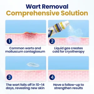 NEGUSY™ ChillErase Bump Renewal Spray