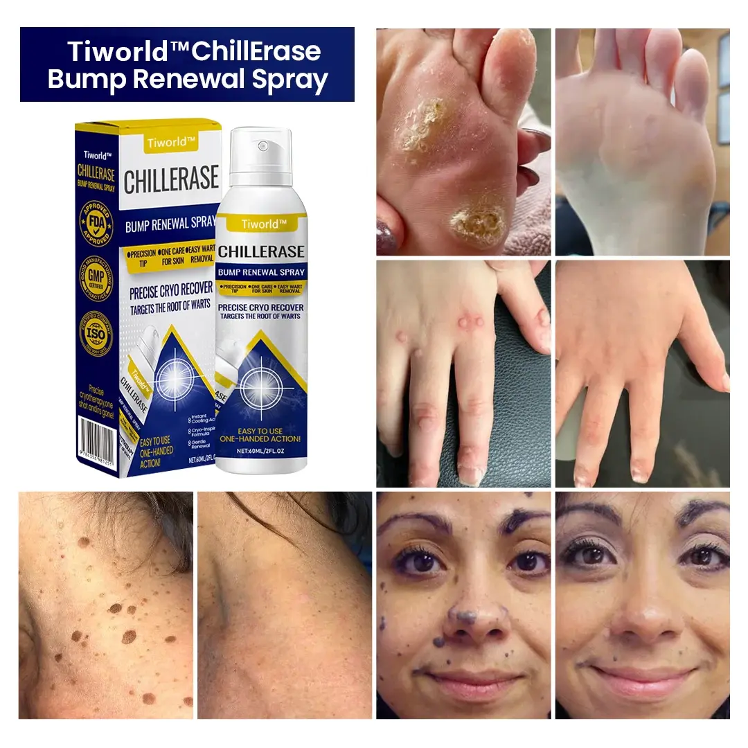 Tiworld® ChillErase Bump Renewal Spray