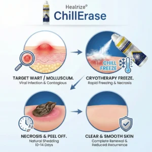 ❄️𝙎𝙥𝙚𝙘𝙞𝙖𝙡 𝙋𝙧𝙤𝙢𝙤𝙩𝙞𝙤𝙣 | Healrize®ChillErase Gentle Bump Renewal Spray ❄️