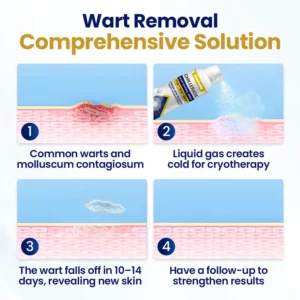 Acezozla® ChillErase Bump Renewal Spray