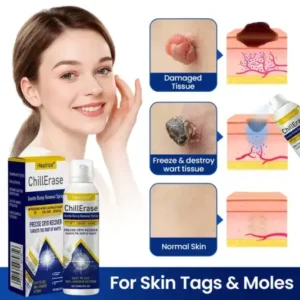 Healrize®ChillErase Gentle Bump Renewal Spray