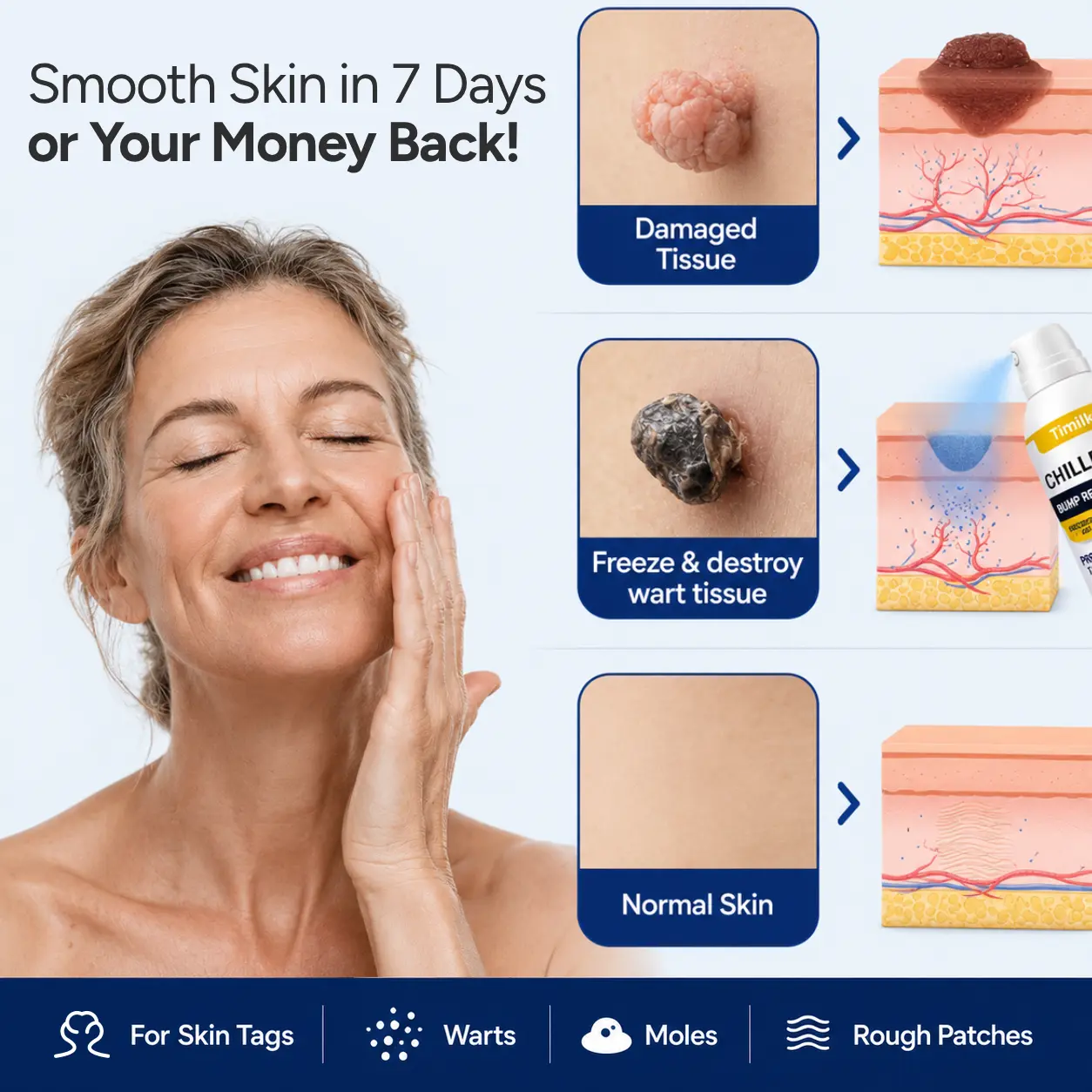 ChillErase Precision Skin Tag & Wart Removal Spray